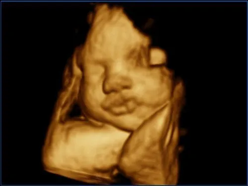 Клинические изображения УЗИ аппарат Esaote MyLab ClassC