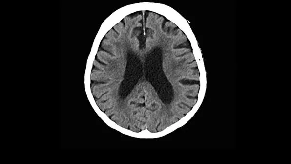 Клинические изображения Siemens SOMATOM go.Now компьютерный томограф