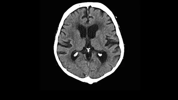 Клинические изображения Siemens SOMATOM go.Now компьютерный томограф