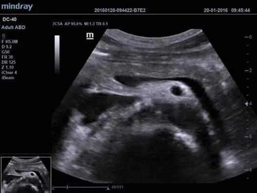 Клинические изображения УЗИ аппарат Mindray DC-40