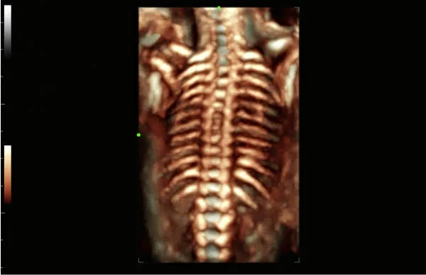 Клинические изображения УЗИ аппарат Mindray Consona N8