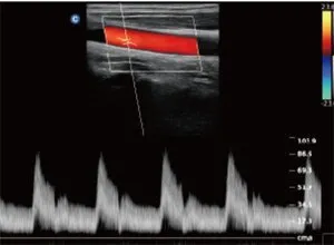 Клинические изображения УЗИ аппарат Chison SonoTouch 80 Pro портативный