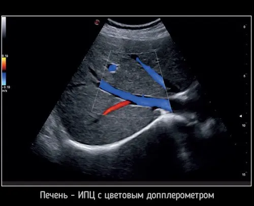Клинические изображения УЗИ аппарат Esaote MyLab X8