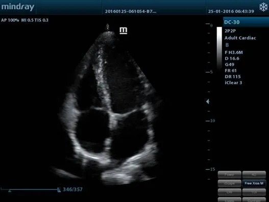 Клинические изображения Mindray M5