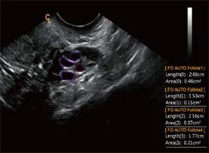 Клинические изображения УЗИ аппарат Chison i8