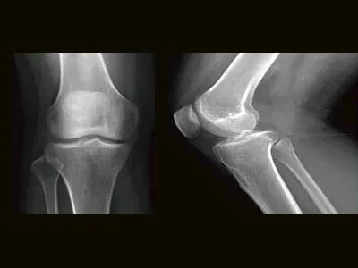 Клинические изображения Brivo XR575 цифровой рентгенографический аппарат GE HealthCare