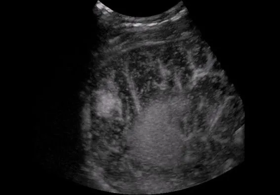 Клинические изображения УЗИ аппарат Mindray DC-8