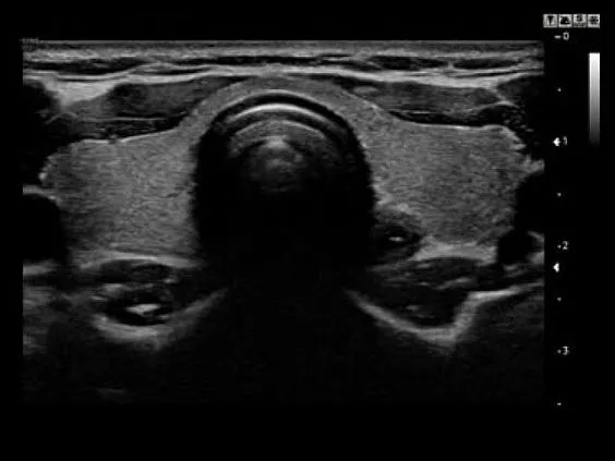 Клинические изображения УЗИ аппарат НПО СКАНЕР РУСКАН 60