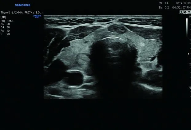 Клинические изображения Samsung Medison RS85 УЗИ аппарат