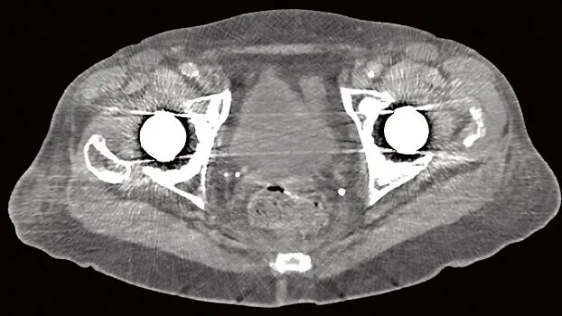 Клинические изображения Siemens SOMATOM go.Up компьютерный томограф