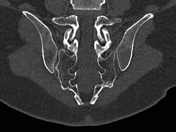 Клинические изображения Siemens SOMATOM go.Now компьютерный томограф