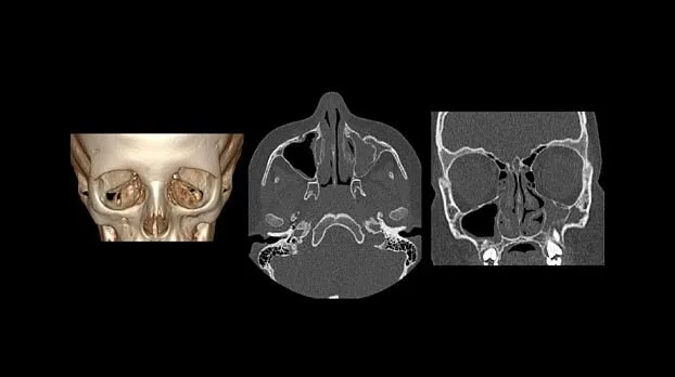 Клинические изображения GE HealthCare Revolution EVO компьютерный томограф