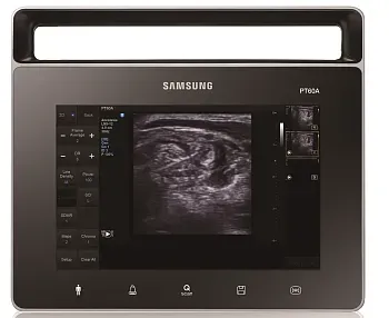 Samsung Medison PT60 УЗИ аппарат