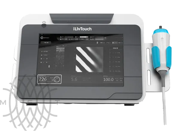 УЗИ аппарат iLivTouch FT 200