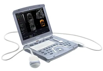 УЗИ аппарат GE HealthCare Voluson I