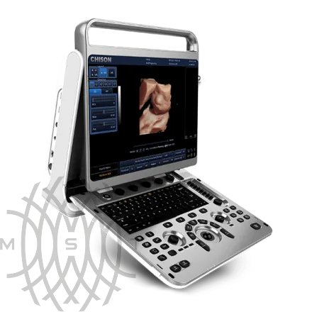 Chison EBit 30 ультразвуковой аппарат