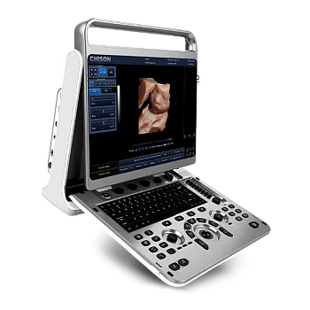 Ультразвуковой аппарат Chison EBit 30