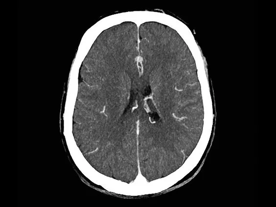 Клинические изображения Siemens SOMATOM go.Up компьютерный томограф