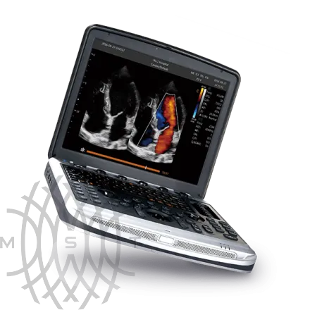 УЗИ аппарат Chison SonoBook 8 портативный