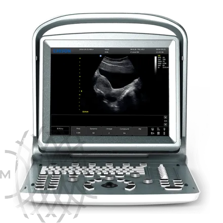 УЗИ аппарат Chison ECO 5