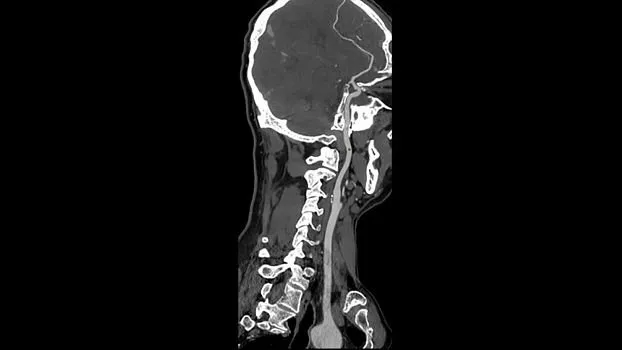 Клинические изображения Компьютерный томограф GE Revolution Ascend