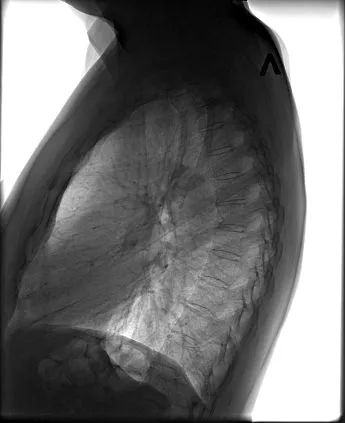 Клинические изображения Флюорограф цифровой С.П.Гелпик РЕНЕКС Ф-5000