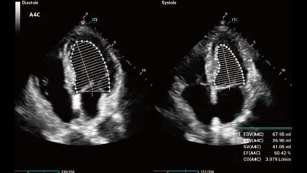 Клинические изображения УЗИ аппарат Mindray Consona N7