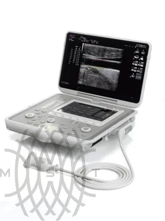 УЗИ аппарат Esaote MyLab Sigma