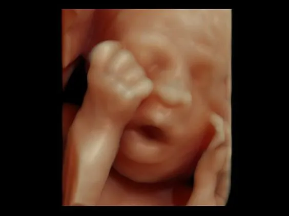 Клинические изображения УЗИ аппарат GE HealthCare Voluson E8 