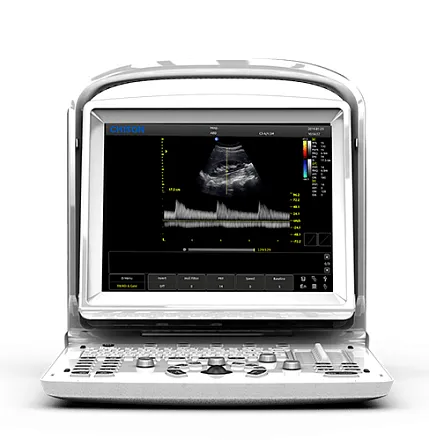 УЗИ аппарат Chison ECO 3 Expert