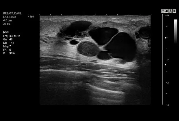 Клинические изображения Samsung Medison HS60 УЗИ аппарат