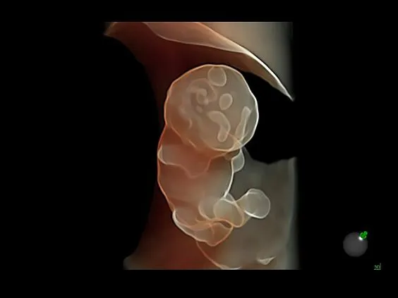 Клинические изображения УЗИ аппарат GE HealthCare Voluson E8 