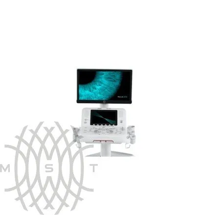 УЗИ аппарат Esaote MyLab X75