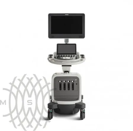 Philips Affiniti 70 ультразвуковой аппарат