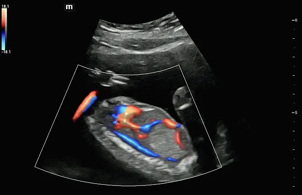 Клинические изображения УЗИ аппарат Mindray Imagyn I9