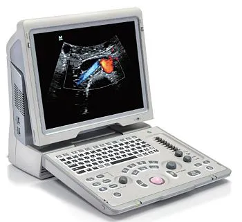 УЗИ аппарат Mindray Z6 портативный