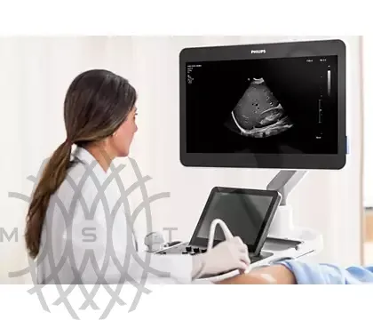 Philips EPIQ Elite ультразвуковой аппарат
