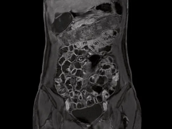 Клинические изображения Магнитно-резонансный томограф Siemens MAGNETOM Aera 1.5T