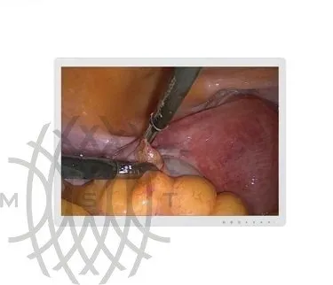 Монитор медицинский Millennium E191P