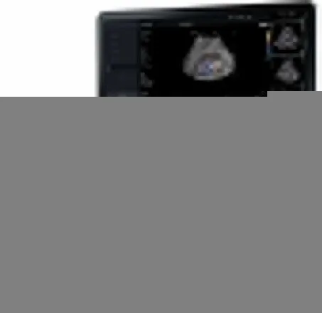 Samsung Medison HS30 УЗИ аппарат