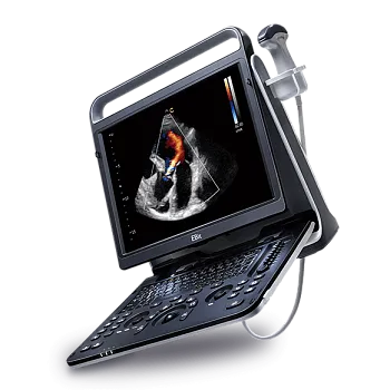 Ультразвуковой аппарат Chison EBit 60