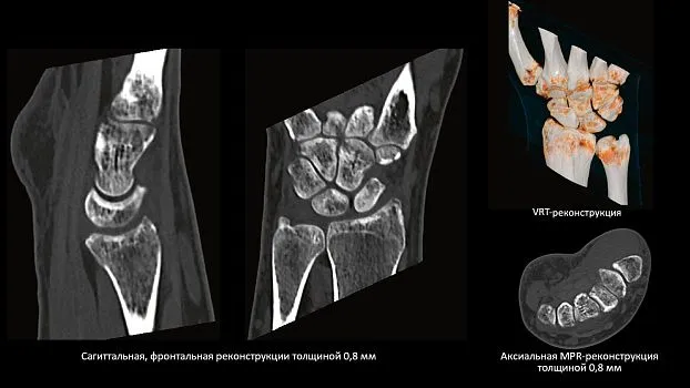 Клинические изображения Siemens SOMATOM go.Up компьютерный томограф