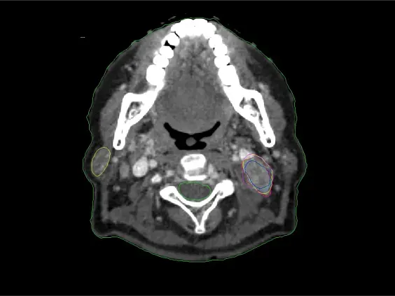 Клинические изображения Siemens SOMATOM go.Sim компьютерный томограф 