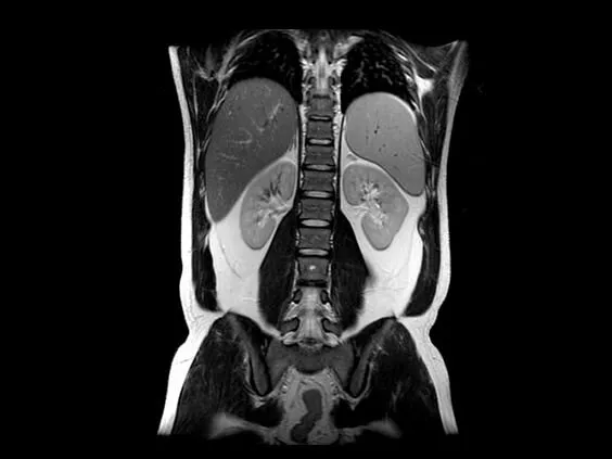 Клинические изображения МРТ аппарат GE SIGNA Explorer 1.5T