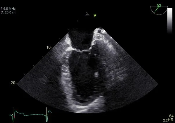 Клинические изображения УЗИ аппарат GE HealthCare Vivid E90