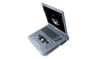 УЗИ аппарат SIUI Apogee 1000 Neo