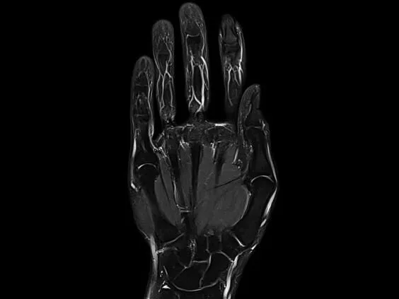 Клинические изображения Магнитно-резонансный томограф Siemens MAGNETOM Aera 1.5T