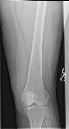 Клинические изображения Цифровой рентгеноcкопический аппарат Siemens Luminos Agile Max