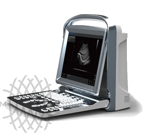 УЗИ аппарат Chison ECO 1