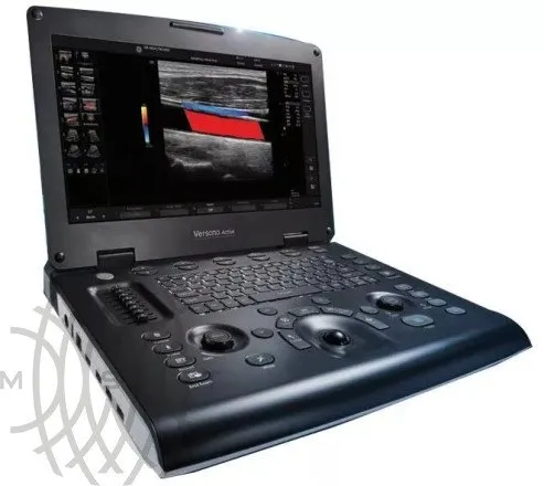 УЗИ аппарат GE Healthcare Versana Active портативный